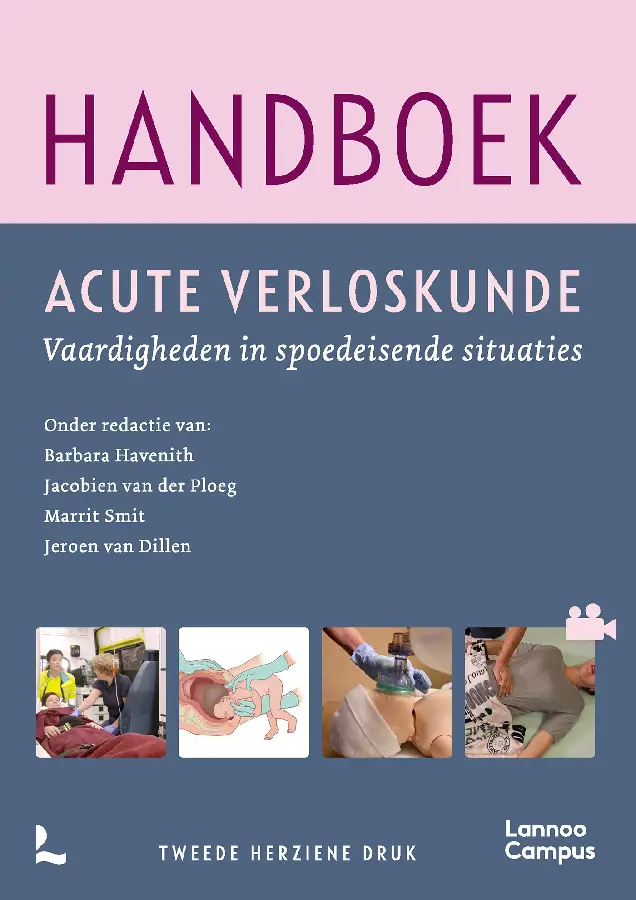 Handboek acute verloskunde