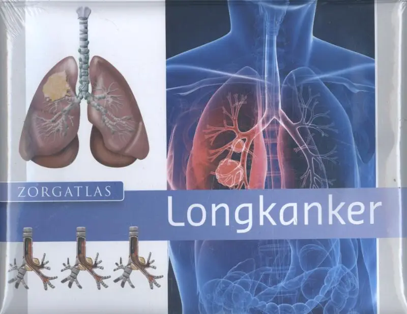 Longkanker