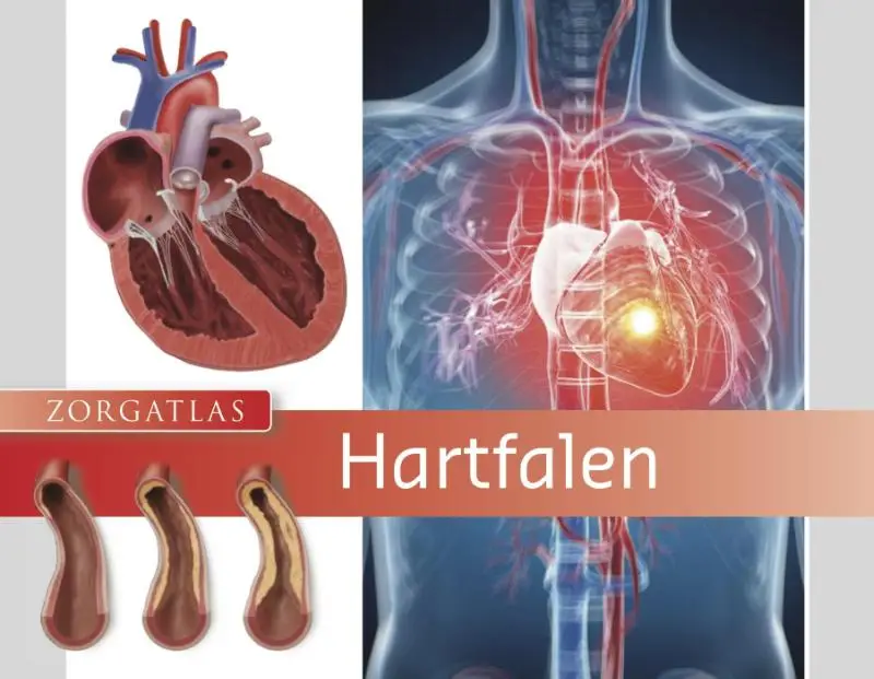 Hartfalen