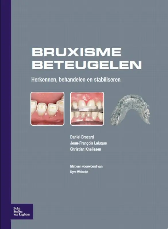 Bruxisme beteugelen